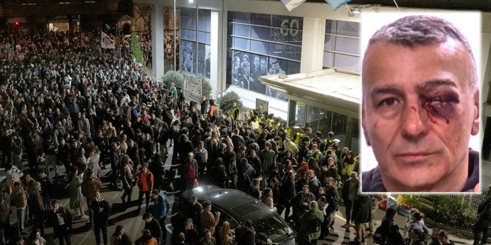 SAD JE SVE JASNO! Unakaženo lice časnog policajca Lazara Baćića je lice siledžijske Srbije!