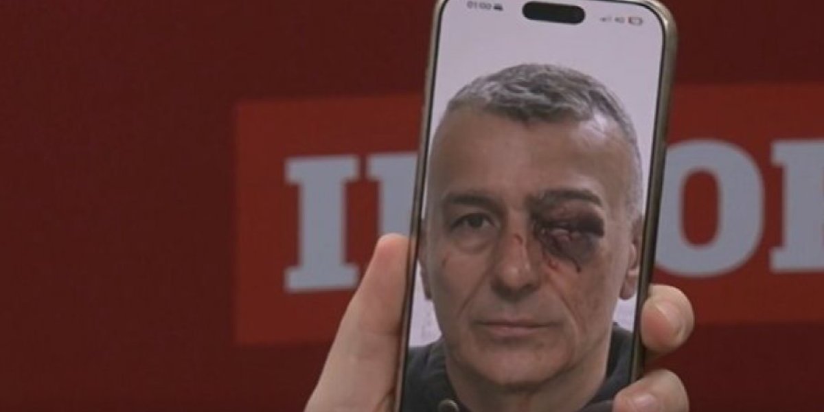 Dobio je mnogo udaraca! Povređeni policajac od samog početka bio ispred RTS-a