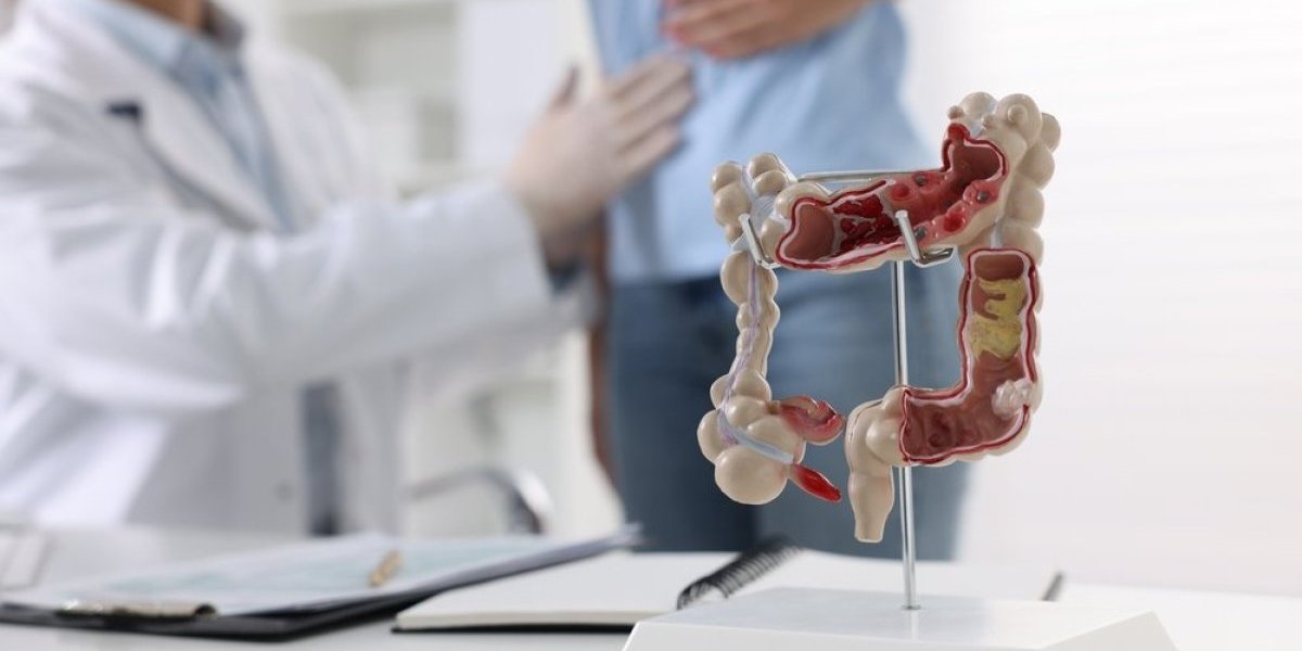 Svi ih jedu, a niko ne zna da izazivaju haos u crevima: Ove namirnice su krivci za gasove i nadutost