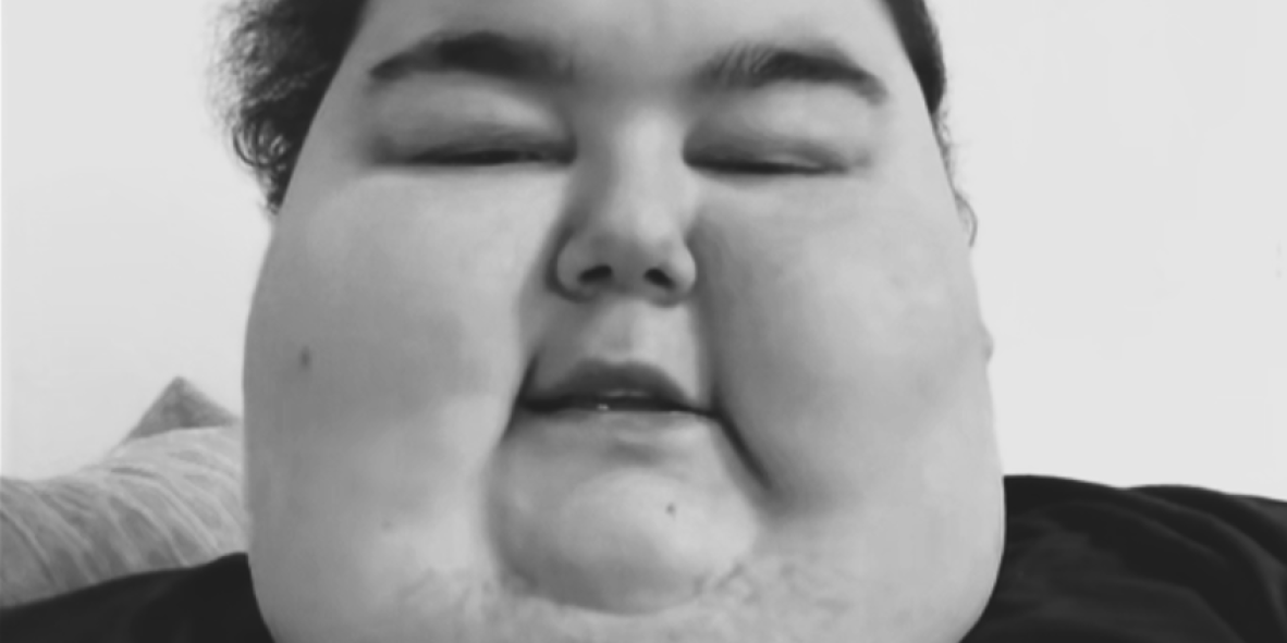 Preminuo poznati tiktoker zbog prejedanja! Zbog svoje nepokretnosti nije mogao da poseti ni majčin grob!