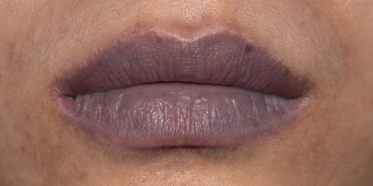 Modre usne mogu biti pogubne za zdravlje! Ukazuju na ozbiljnu anomaliju