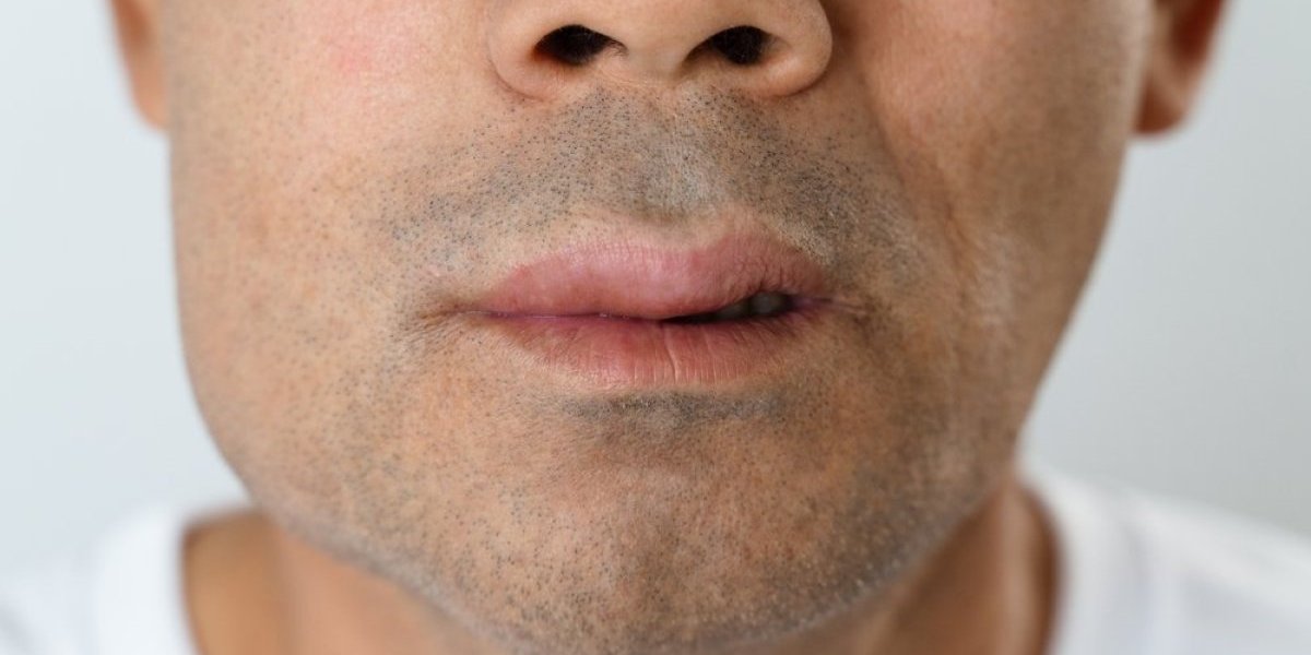 Pet dana je trpeo bol, a onda mu je brada za dlaku eksplodirala! Doktori su mu dali 24 sata života