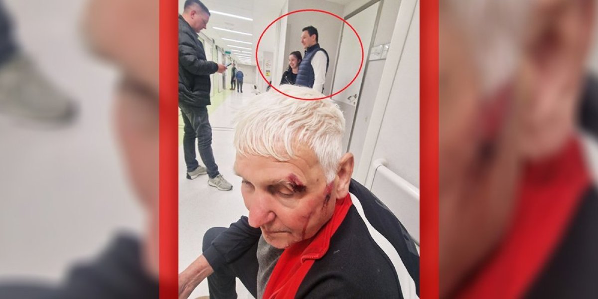 Strašno nasilje blokadera! Dok Šarović glumi žrtvu, deka zbog "kore od banane" završio krvav u hodniku Urgentnog! (FOTO)