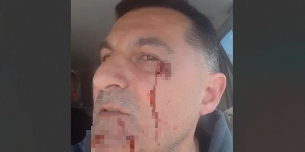 Drama u Crvenki! Blokaderi pretukli čoveka nasred ulice - razbijena mu arkada! (VIDEO)