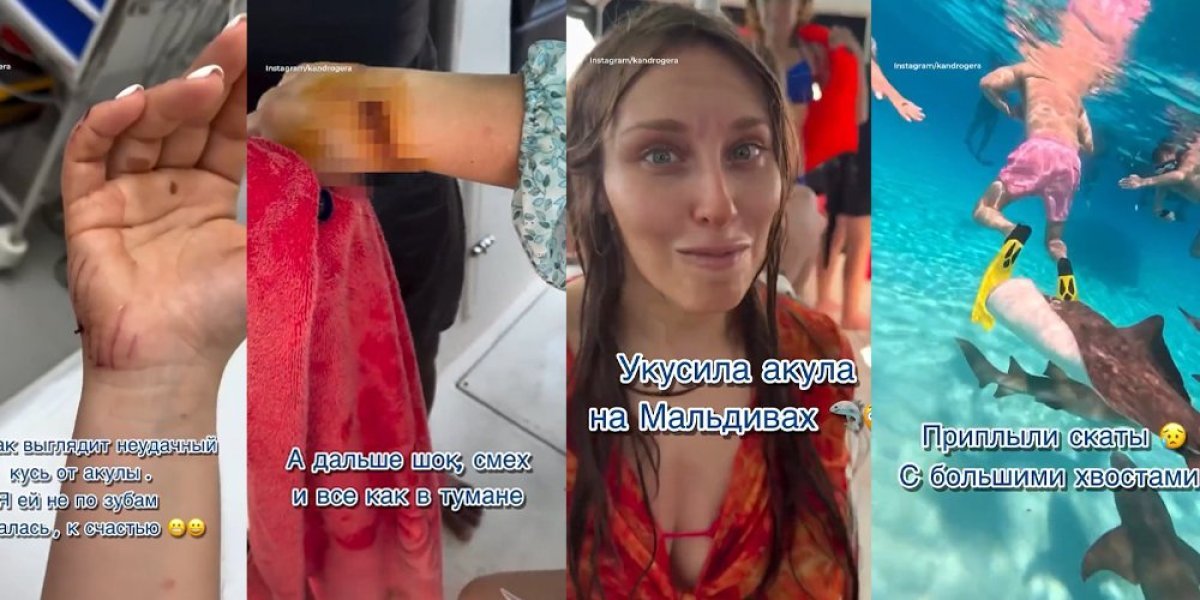 (UZNEMIRUJUĆE) Ruskinju ujela ajkula na Maldivima! Jedva izvukla živu glavu, čamac bio pun krvi!