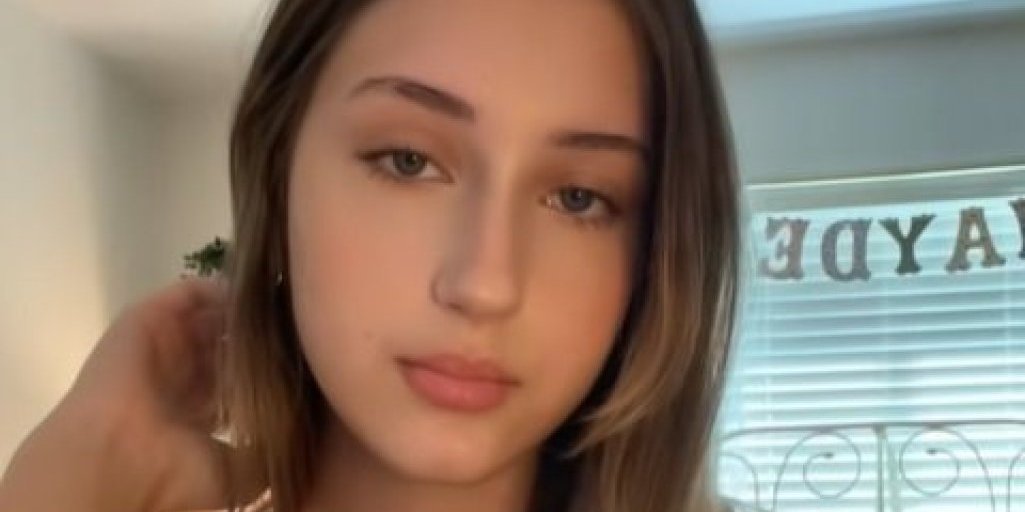 Rođena sa "staklenim zubima"! Lepa kao anđeo, a kada se nasmeje svi beže od nje (VIDEO)