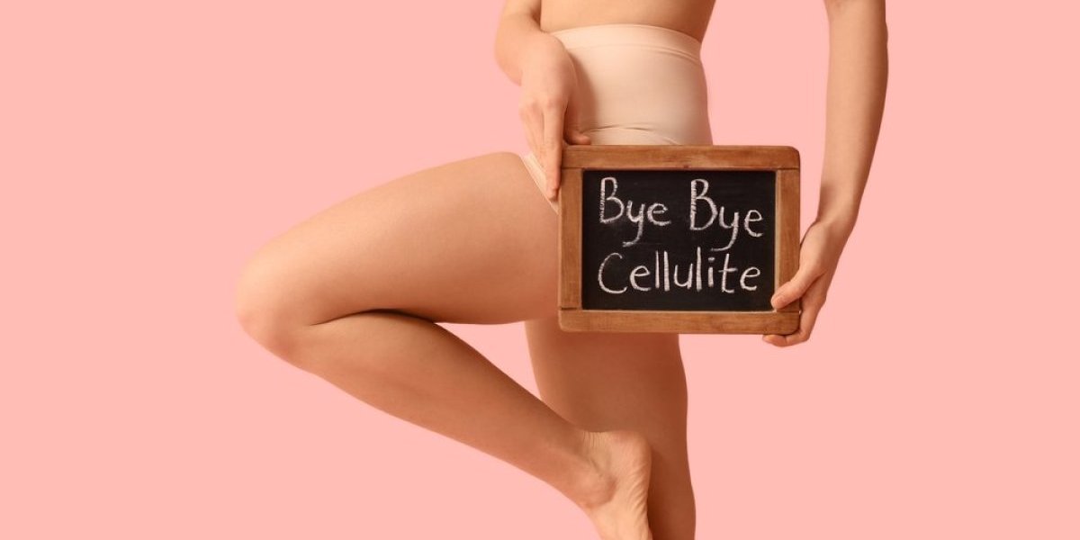 Jeftino rešenje protiv celulita! Trebaju vam samo 2 sastojka