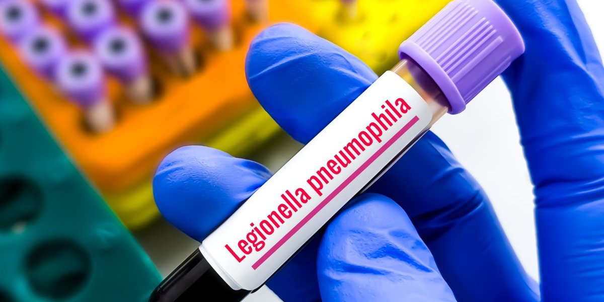 Opasna bakterija nalazi se u tuševima i klima uređajima! Možete se smrtonosno zaraziti: Ako osetite ove simptome, odmah se javite lekaru