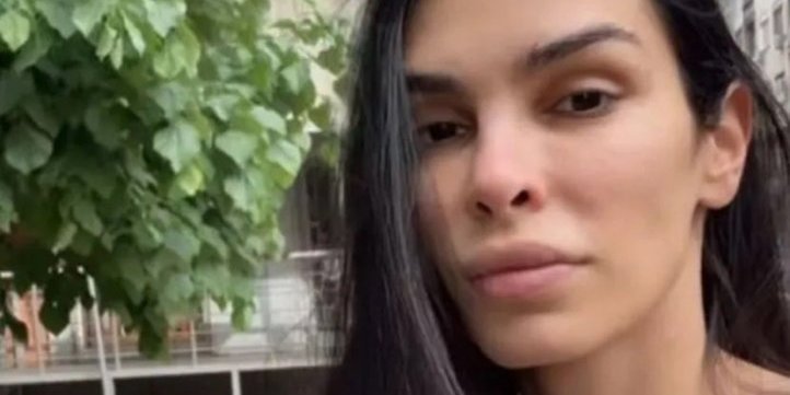 Manekenka prošla kroz pakao! Jovana se otrovala u beogradskom restoranu, lice joj je neprepoznatljivo