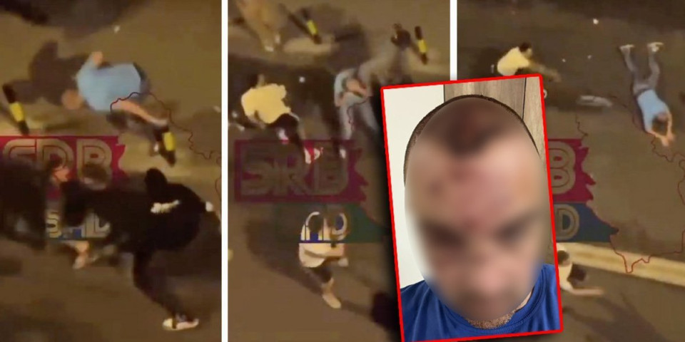 Oglasio se momak koji je učestvovao u tuči sa igračima Partizana: Posekli su me nožem preko oka i nosa, a onda mi razbili flašu o glavu!