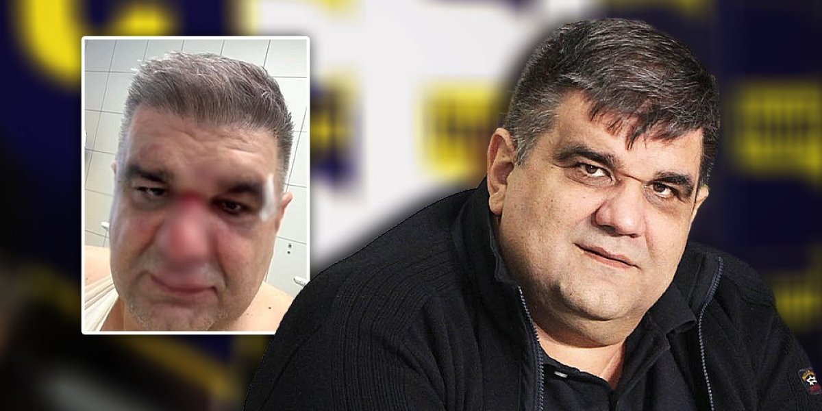 Operisan Saša Mirković! Evo u kakvom se stanju nalazi!