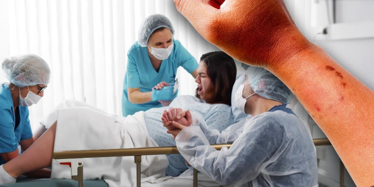 Zaražena žena ujela doktora usred porođaja! Pokušao da spasi i nju i bebu, pa izvukao deblji kraj: Nije bilo leka!