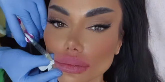 Ne može da ih ukroti! Tamara Đurić na operacionom stolu, svi gledaju u cice (FOTO)