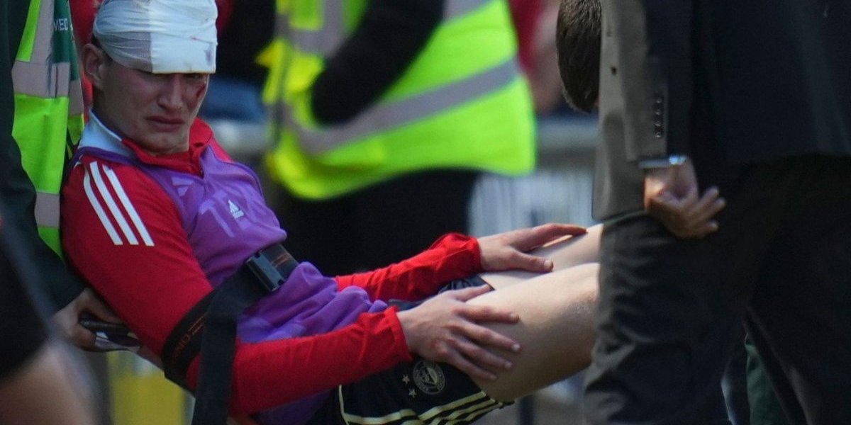 Škoti su najluđi, navijači razbili fudbaleru glavu stolicom (VIDEO/FOTO)