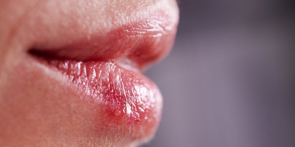 Usne vas peku i užarene su, zaradili ste opekotine: Evo kako da efikasno rešite problem i zaštitite ih od sunca