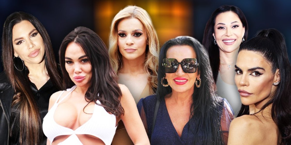 Ove poznate dame gorko su se pokajale: Plastične operacije ih uništile