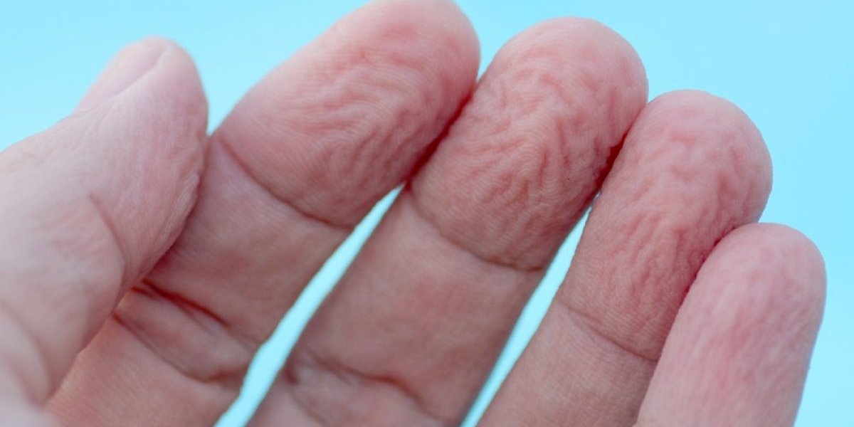 Prsti otkrivaju kakvo vam je zdravlje : Ako se ne smežuraju u vodi, imate ozbiljan problem