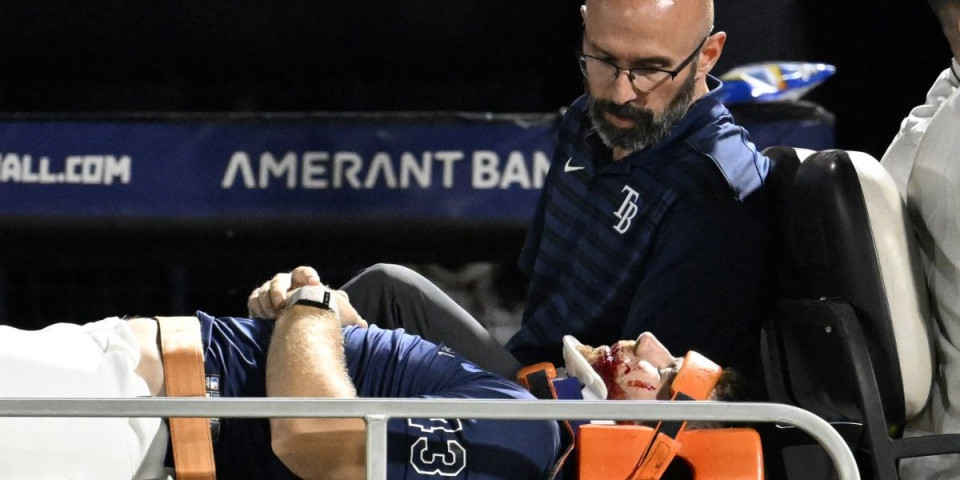 Jezive scene... Igrač nokautiran: Pogodila ga lopta brzinom 170 km na sat (VIDEO)