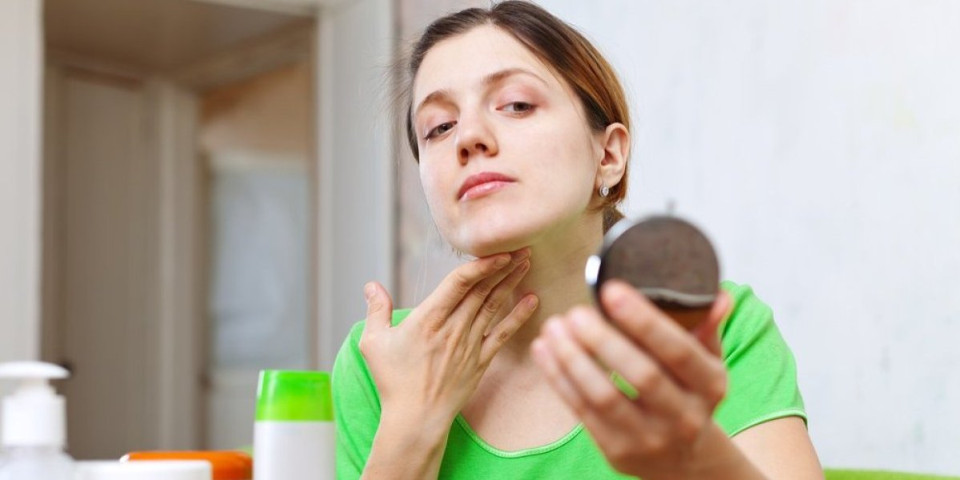 Zašto se pojavljuju bubuljice na vratu posle 40. - Evo šta ih uzrokuje i kako da ih tretirate