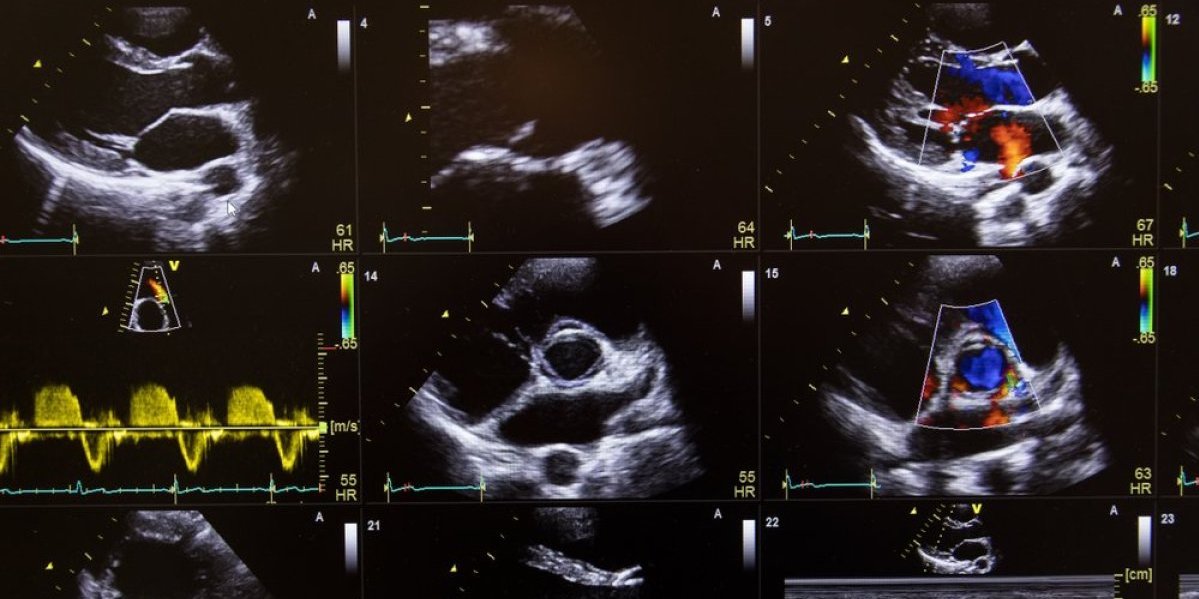Prvi snimak kako nastaje srce: Naučnici zabeležili istorijski trenutak - otkriće koje će pomoći u lečenju srčanih mana (VIDEO)