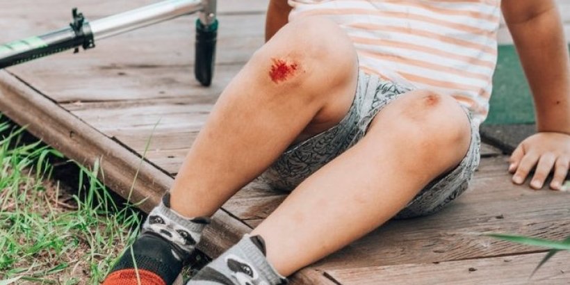 Doktorka upozorava na ozbiljne posledice: Ranu nikako ne ostavljajte da se sama osuši