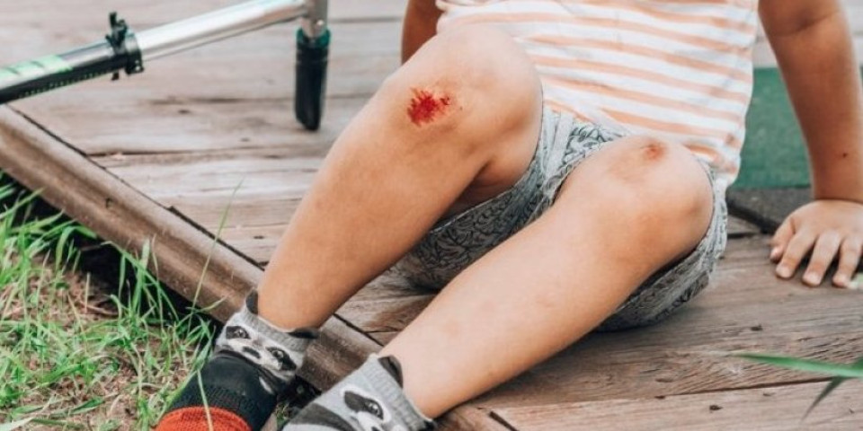 Doktorka upozorava na ozbiljne posledice: Ranu nikako ne ostavljajte da se sama osuši