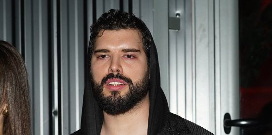 "Danas ste sigurno bolje od mene": Adam Adaktar sav u opekotinama - Hitno se obratio javnosti