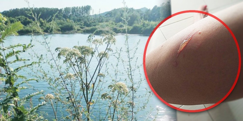 Biljka "ubica" stigla do Drine: Samo jedan dodir i možete trajno izgubiti vid