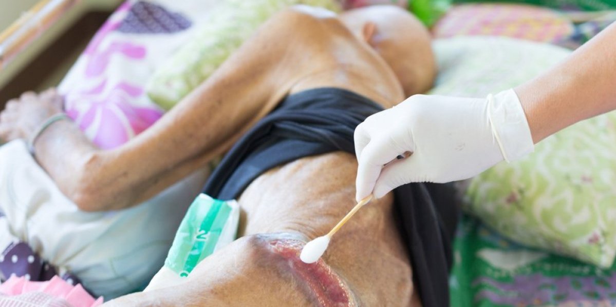 Čovek se zarazio bolešću srednjeg veka preko mačke: Za nekoliko sati stvorili su se čirevi po telu, lekari su bili u šoku