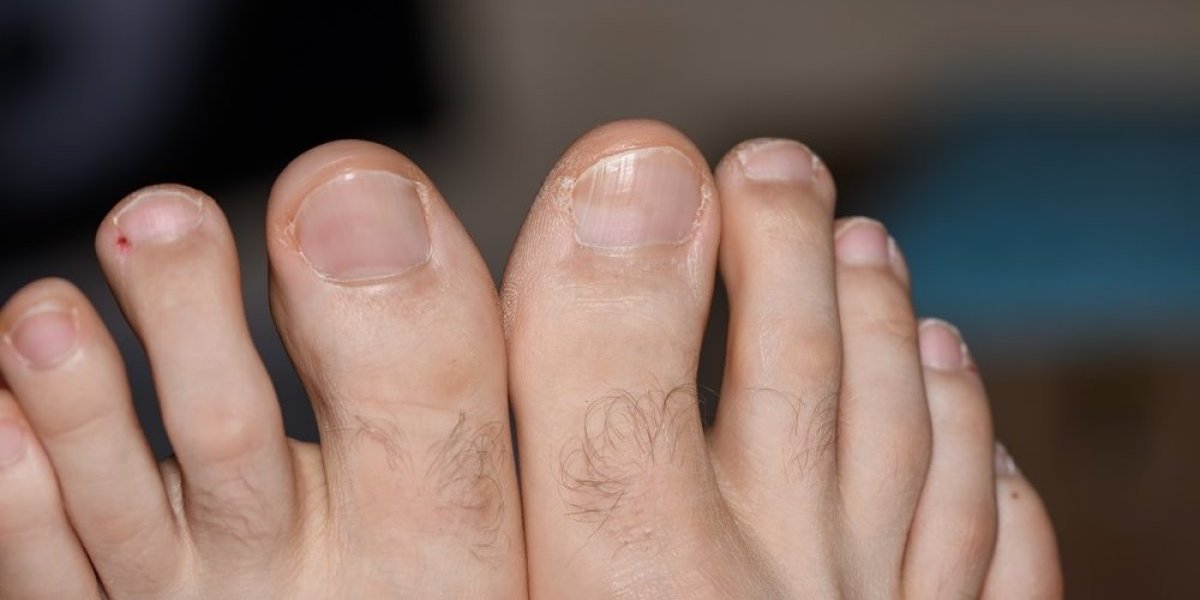 Dlačice na nožnim prstima vam šalju važnu zdravstvenu poruku - Žene, ne zanemarujte je