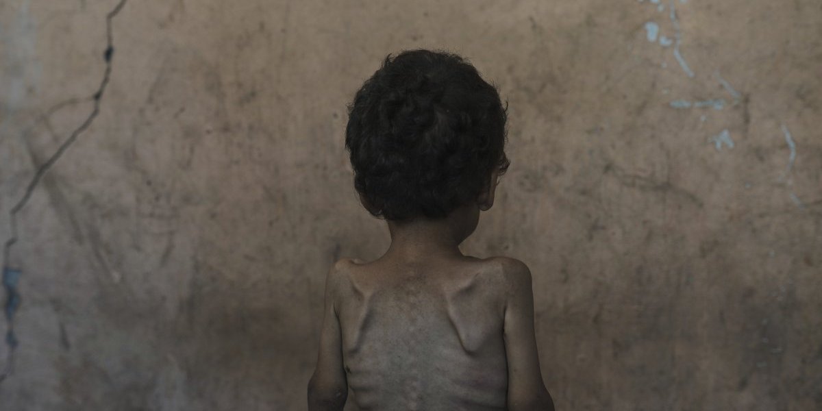 Izraelska vojska pravi dnevne pauze: Humanitarni predah usred pakla Gaze (FOTO)