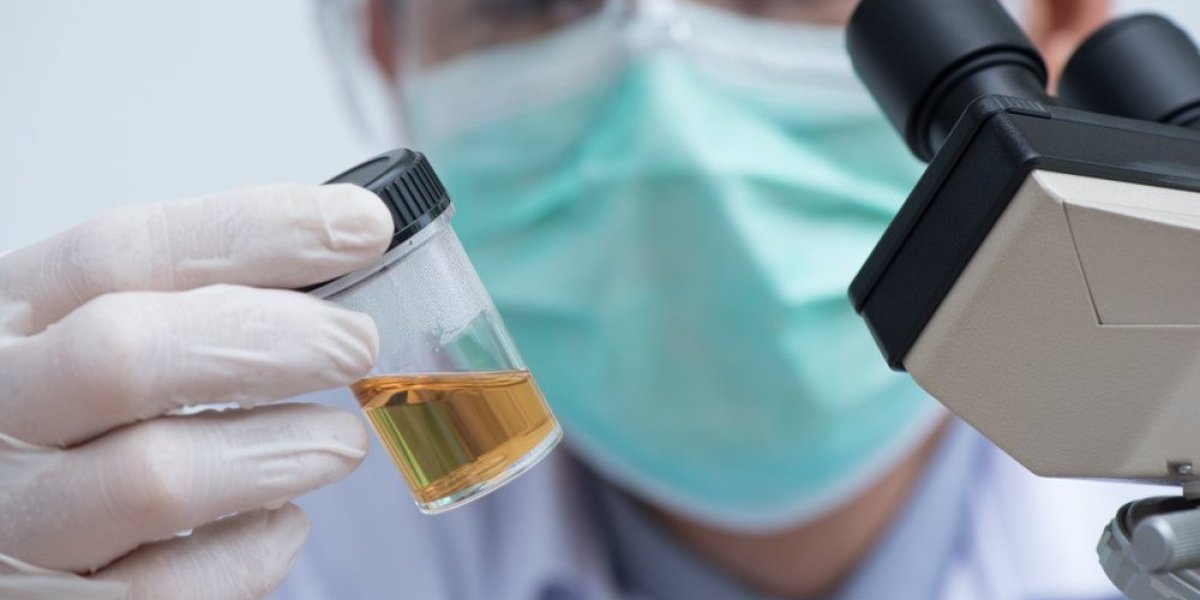 Osećate umor, glavobolju i imate tamnu boju urina? Evo šta vam poručuje organizam