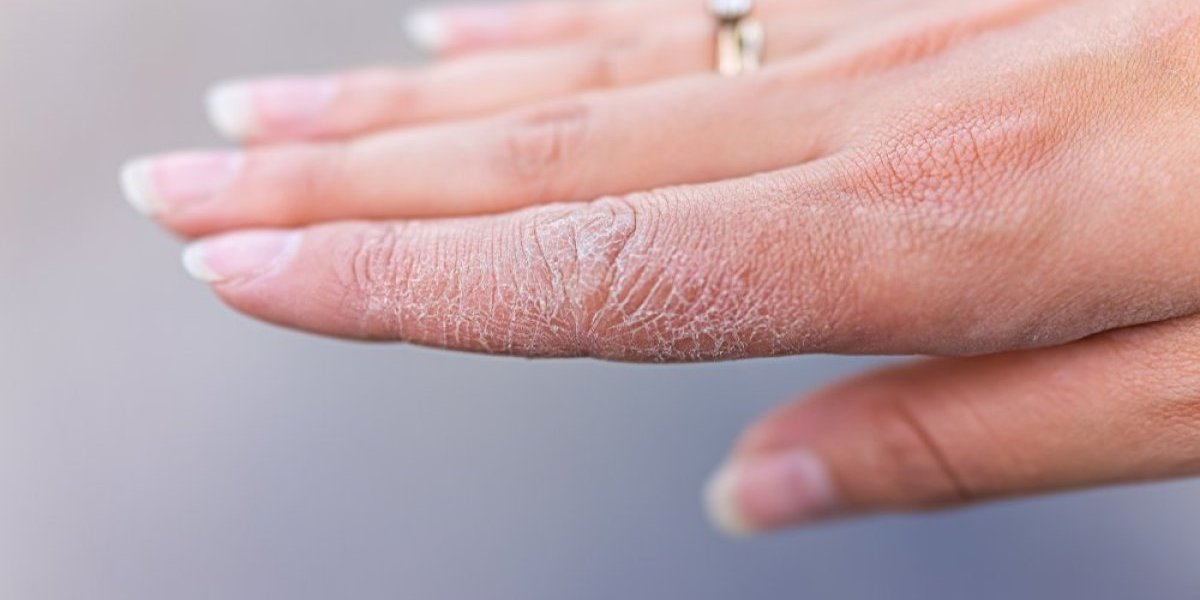 Kako napraviti domaću kremu za ruke: Jednostavan recept za negu i hidrataciju