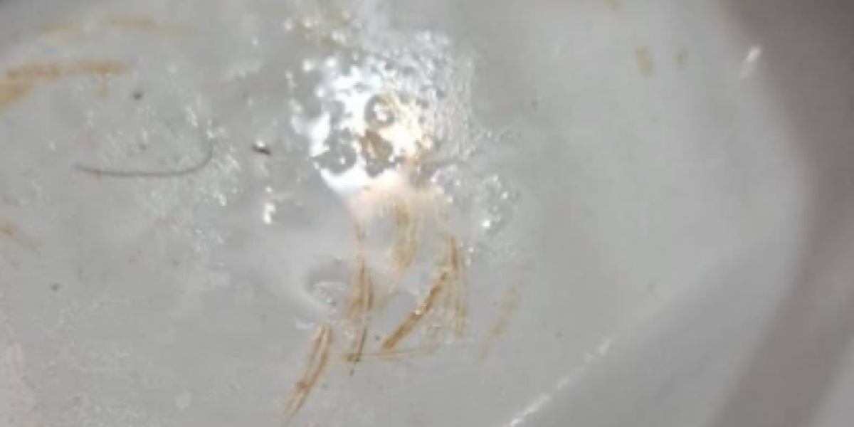 Prljavština u kupatilu