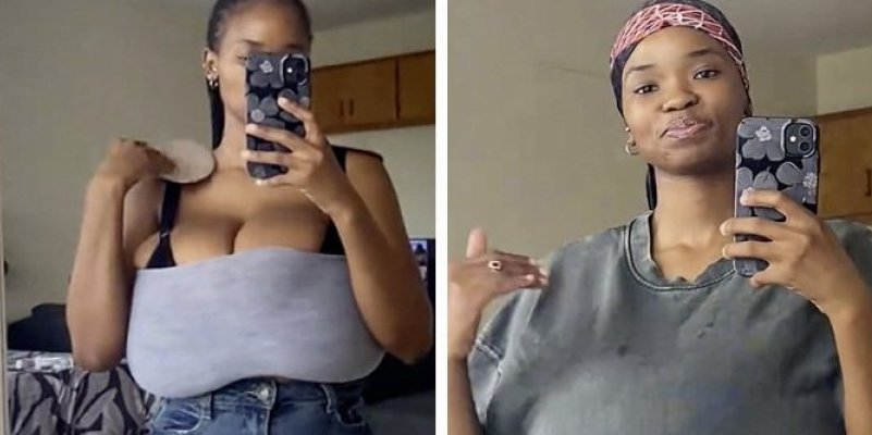 Grudi joj nekontrolisano rastu: Zbog džinovskog poprsja se jedva kretala - bolovi su nepodnošljivi (VIDEO)