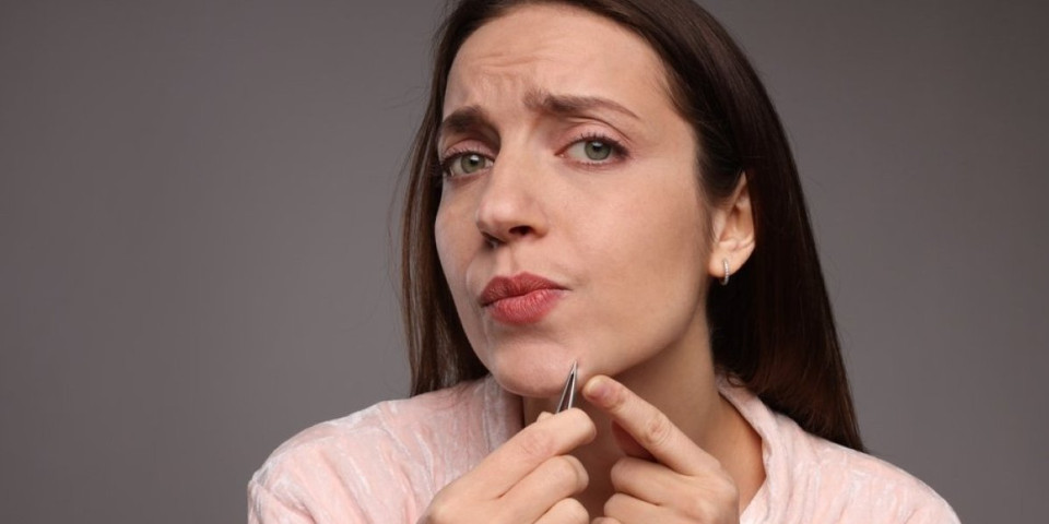 Zbog ove namirnice možete dobiti dlake na licu: Saznajte šta izaziva dlakavost kod žena