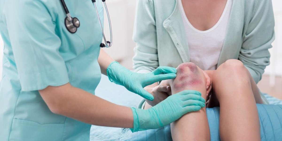 Često vam se pojavljuju modrice i krvarenje iz nosa? Moguće je da je u pitanju opaka bolest