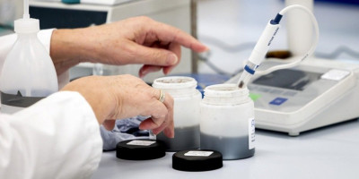 Američki predsednik Donald Tramp izjavio je da postoji veza između korišćenja leka protiv bolova Tilenol (paracetamol) u trudnoći i pojave autizma kod dece. Međutim, srpski lekari ne mogu da podrže njegovu izjavu, jer je potrebno da Svetska zdravstvena organizacija objavi zvaničnu potvrdu o tome.