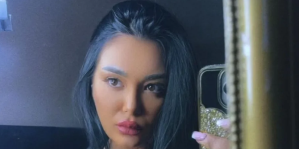 Botoks joj izdeformisao lice - Influenserka nakon tretmana izgleda kao da je izujedao roj pčela (FOTO)