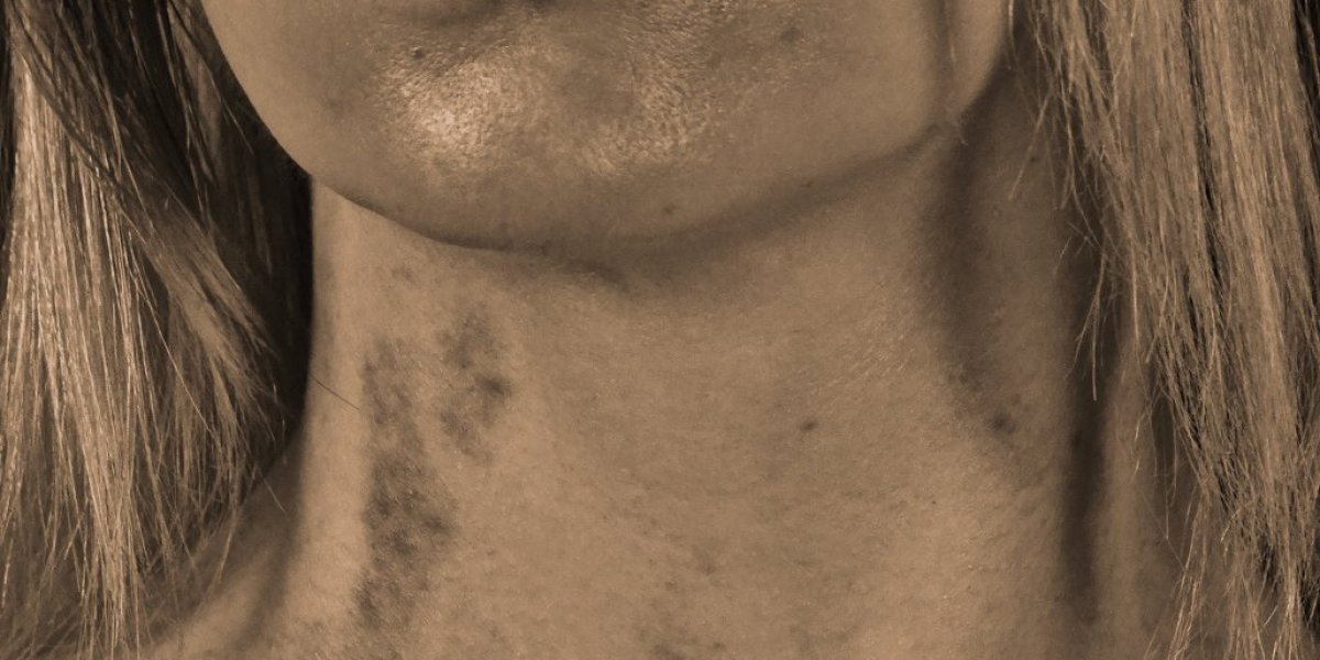 Davljenje tokom seksa može imati fatalne posledice: Zbog pornografije mnogi misle da je bezopasno