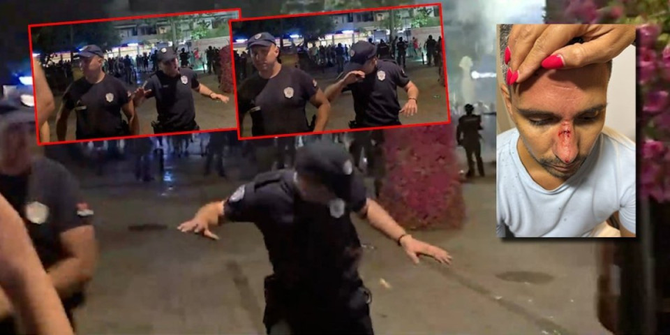 Blokaderski naci pir u Bačkoj Palanci: Velibora pogodili kamenom u lice, povređen i policajac (FOTO/VIDEO)