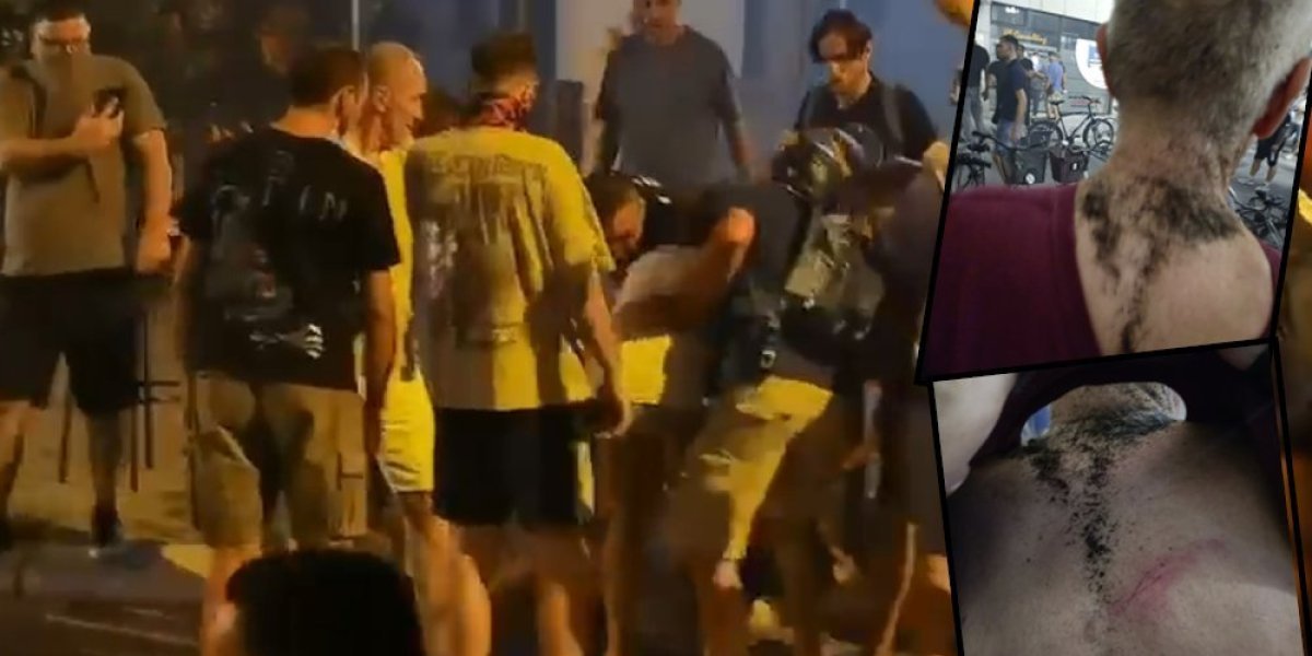 Nezapamćeni teror blokadera: Pogledajte kako izgleda povređeni muškarac u Novom Sadu (FOTO)