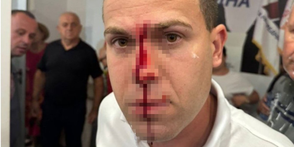 Teško povređen građanin u Lazarevcu! Jezivo nasije blokadera - pogodili ga u glavu, krv na sve strane (FOTO)