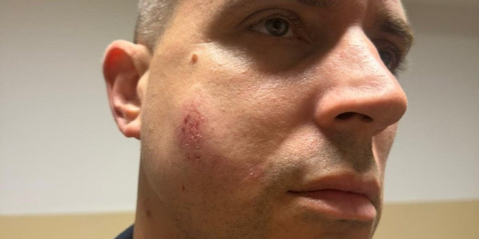 Povređeno sedam policajaca u Pančevu! Jednog od njih blokaderi gađali kamenom u glavu - jezivo (FOTO)