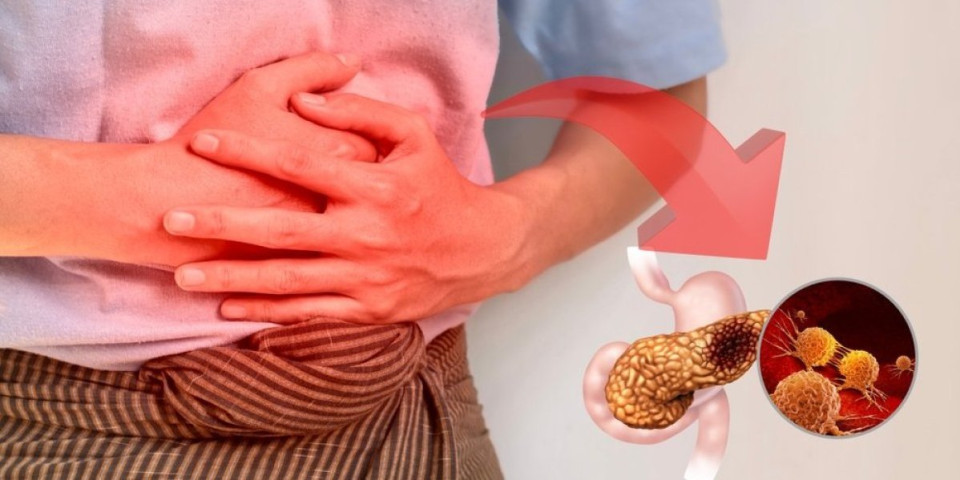 3 vrste raka koje je najteže otkriti: Dijagnoza stiže kasno već kada je u završnoj fazi