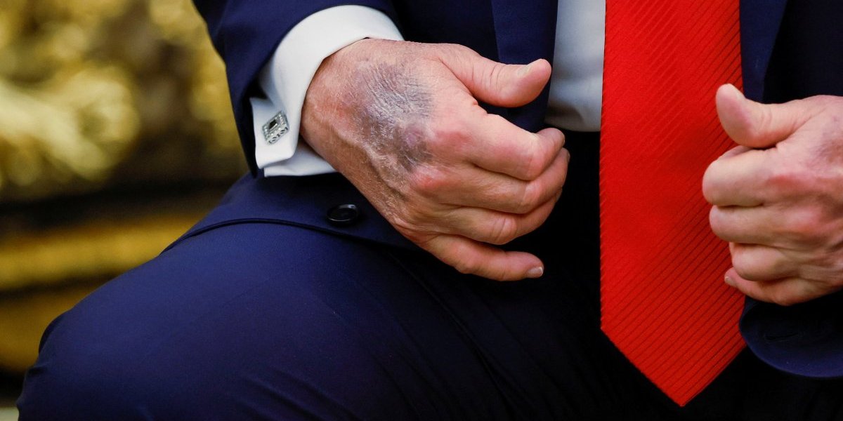 Šta se događa sa Trampom?! Slika koja kruži zabrinula svet - da nije... (FOTO)