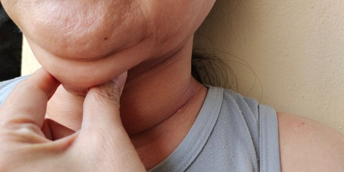 Hitno upozorenje: Debeo vrat opasniji od sala na stomaku - Tihi ubica je