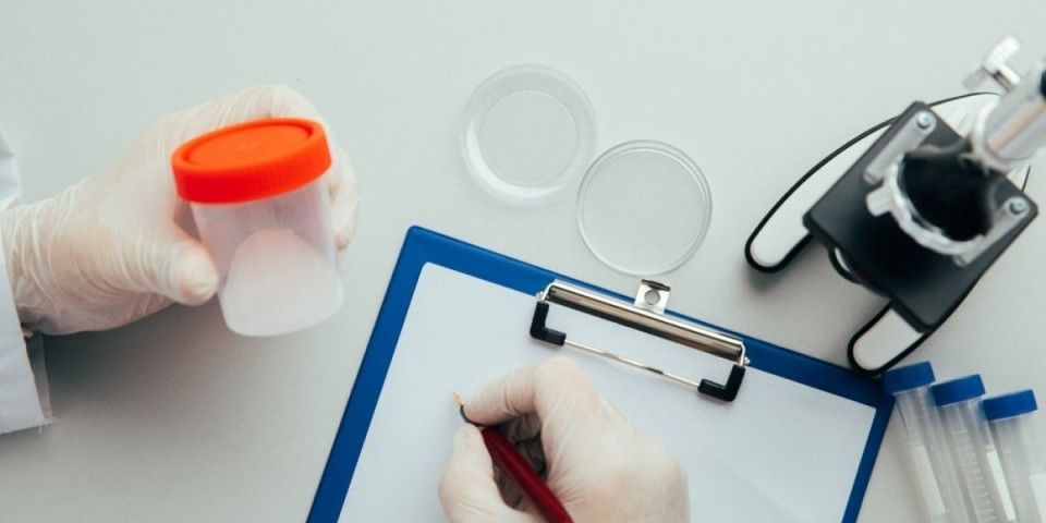 Muškarci, telo šalje signale: Obratite pažnju na promene u boji sperme