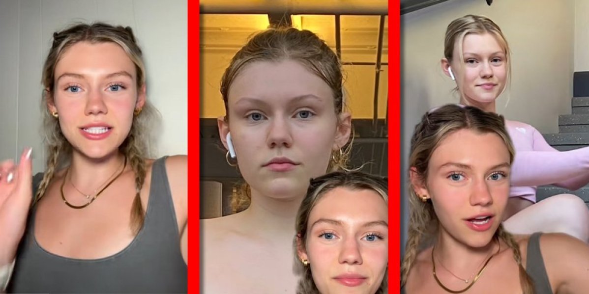 Da li imate kortizol lice? Mreže gore, evo kako izgleda i o čemu se radi (VIDEO)