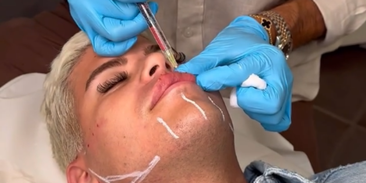 Uroš Stanić na korekciji celog lica